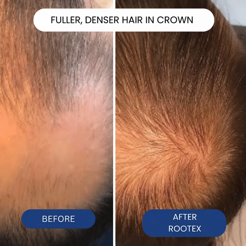 RootWise Hair Growth Roll-On Serum