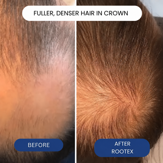 RootWise Hair Growth Roll-On Serum